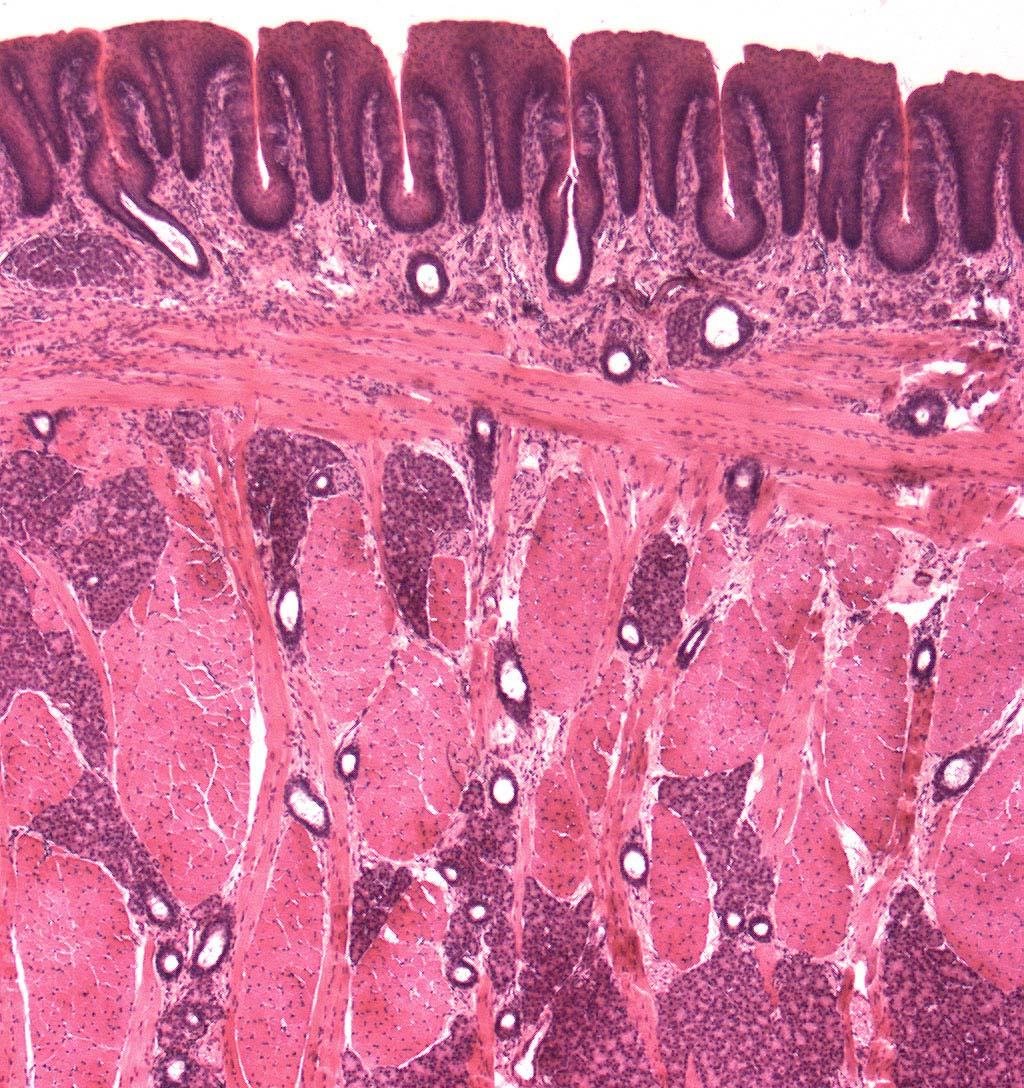Zunge, Papillae foliatae (blattförmige Papille) Detail: Blattlagen Präparat 42 Färbung HE Papillae foliatae 1 angeschnittener Drüsenausführunggang