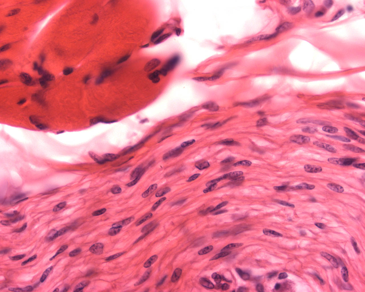 Zunge, Papillae vallatae, Detail 2: Muskel und Nerv Präparat 44 Färbung HE Skelettmuskelfaser (randständige Kerne,