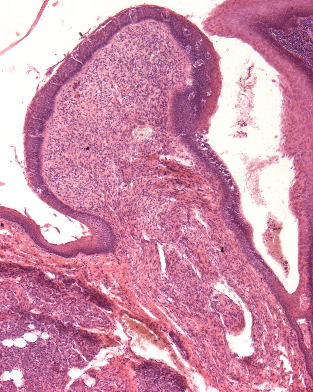Zunge, Papillae fungiformes (pilzförmige Papille) Detail: Pilzform Präparat 39