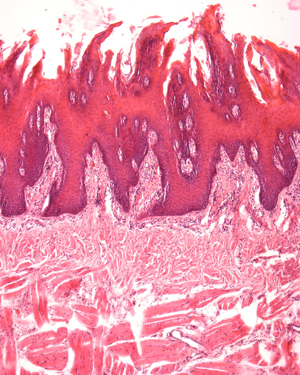 Zunge, Papillae filiformes (haarförmige Papille) Detail: Haarform Präparat 40 Färbung HE Pap.