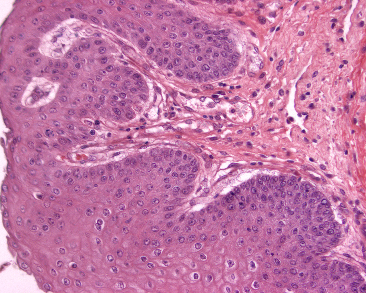 Uvula- weicher Gaumen Detail 1: Plattenepithel Präparat 50 Färbung HE Bindegewebspapillen Fibrozyten