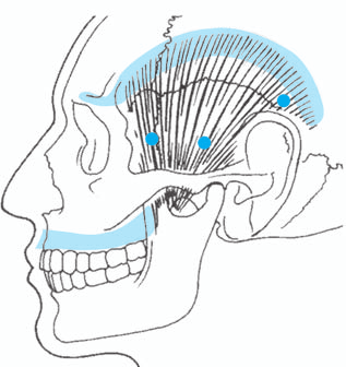 Kopfbereich/ Kauapparat 15 6.1.2 M. temporalis (Abb. 8) Wirkung: hebt den Unterkiefer, zieht ihn etwas nach hinten.