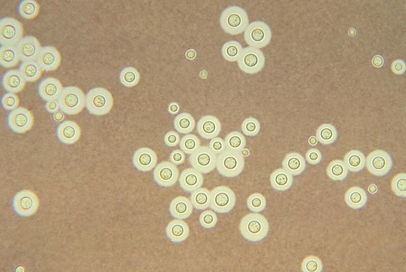 Radiophilie Organismen Cryptococcus neoformans