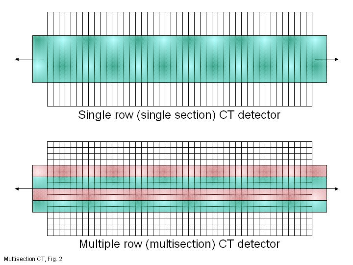 Multislice CT Mehrere Detektoren schichtweise nebeneinander Simultane Aufnahme mehrerer Schichten moderne Systeme messen 64 Schichten 16 *