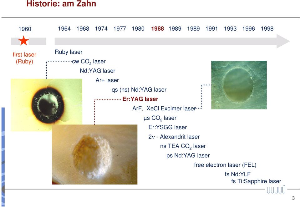 Er:YAG laser ArF, XeCl Excimer laser µs CO 2 laser Er:YSGG laser 2ν - Alexandrit laser