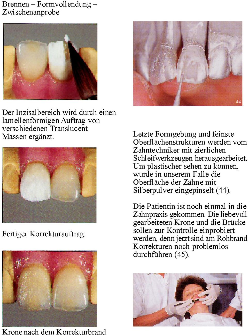 Um plastischer sehen zu können, wurde in unserem Falle die Oberfläche der Zähne mit Silberpulver eingepinselt (44).