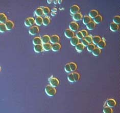 Grundformen der Einzelzellen Kokken: Größe: 0,3 0,5 µm Mikrokokken, Diplokokken, Streptokokken, Sarcinia (4er Pakete) Stäbchen: