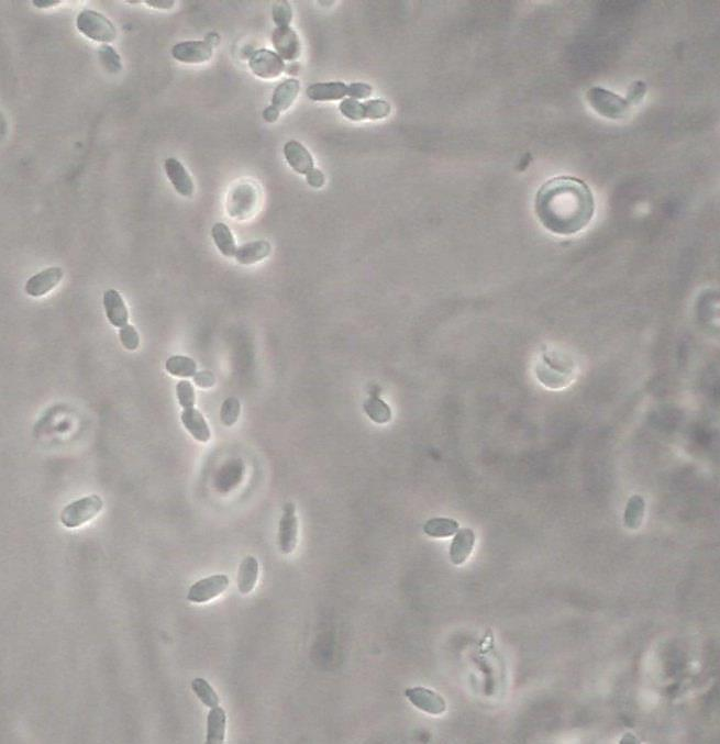 Hefezellen oval Hefezellen in der ovalen Form Hefezellen in der Mutter-Kind Stellung Vermehrtes Vorkommen von Hefezellen ohne Erhöhung der