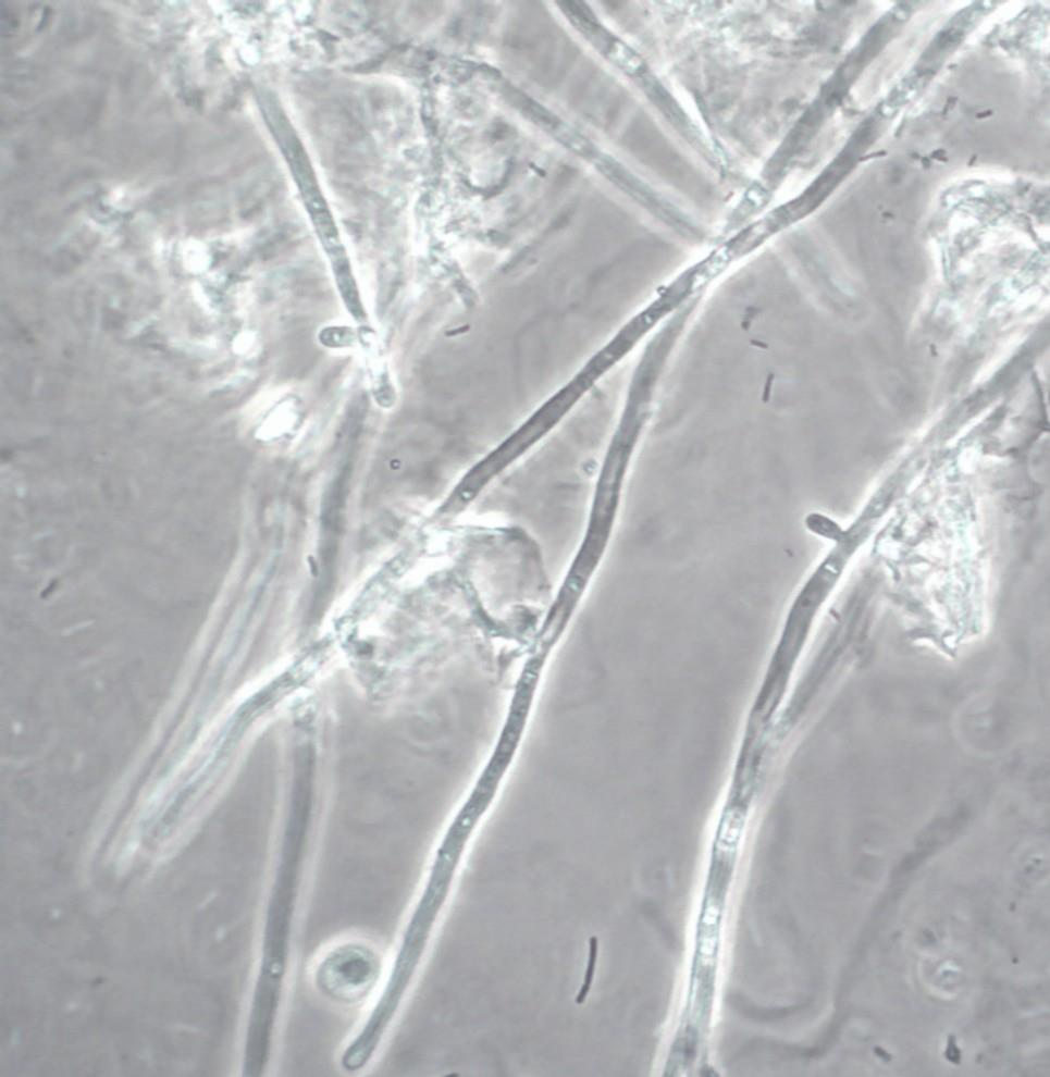 Pilzfäden Pilzfäden stellen sich im frischen Urin als Schläuche dar und sind damit eindeutig von dünnen Bakterienfäden (lange