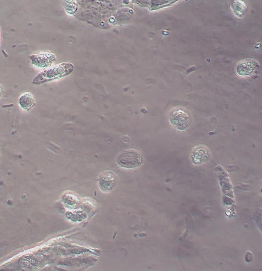 Tiefe Urothelzelle Tiefe Urothelzellen befinden sich in der unteren Schicht des Urothels.