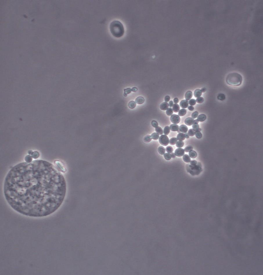 Altes Epithel oder Artefakt Auch Epithelien (linker Bildrand) unterliegen einem Alterungsprozess. Man kann hier keinen Zellkern, jedoch viele Vakuolen im Zytoplasma erkennen.