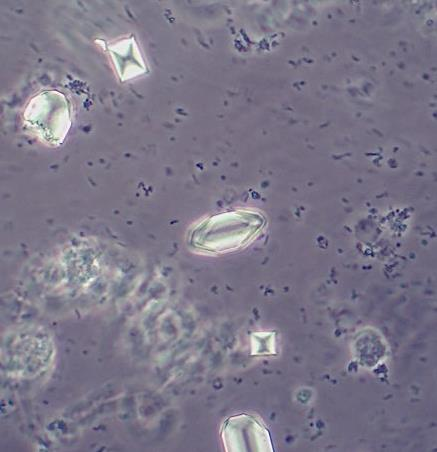 Tripelphosphate Tripelphosphate haben eine sargdeckelförmige Gestalt.