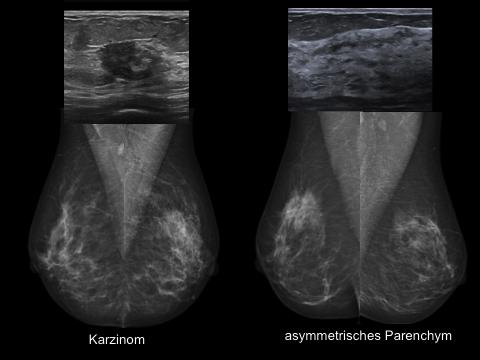 Prozessdefinition Einsatz des Ultraschalls im Rahmen von Brustuntersuchungen