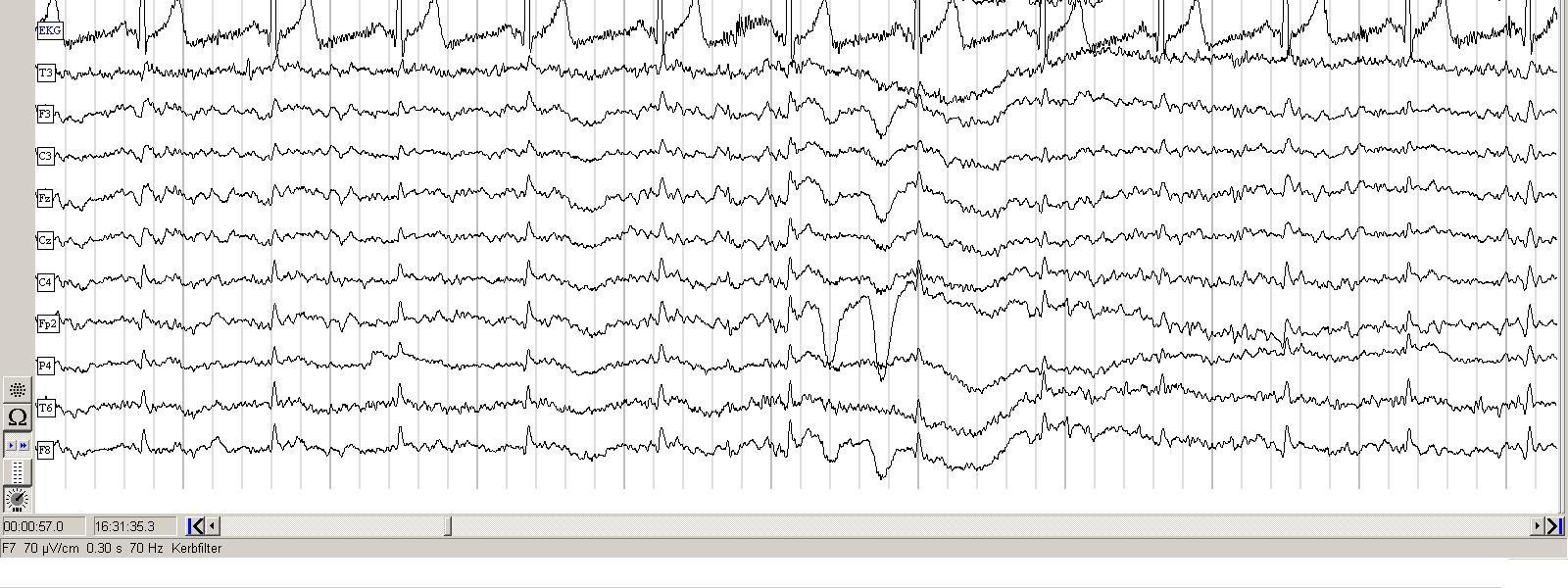 4 Konzept für Einsatz eines EEG-Gerätes in einem Usability-Labor 50 4.