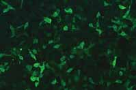 Autoantikörper Muster IIFT Nachweissysteme PCA-2 * Autoantikörper gegen ein 280-kDa- Protein der Purkinje-Zellen des s IIFT: Fluoreszenz des Purkinjezell-Cytoplasmas des s, die sich bis in die