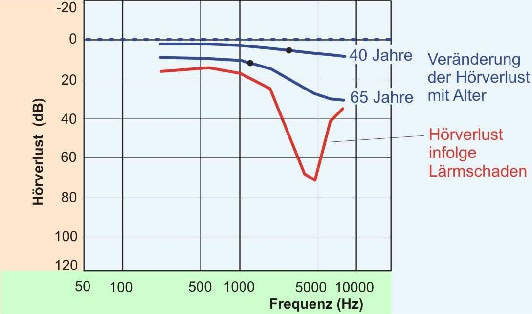 Modell heutzutage: Frequenzanalyse + aktiver nichtlinearer Filtereffekt Modell: (a) Basilarmembrane in der Ruhe Ablenkung 37 Hz, 1.3 khz,.