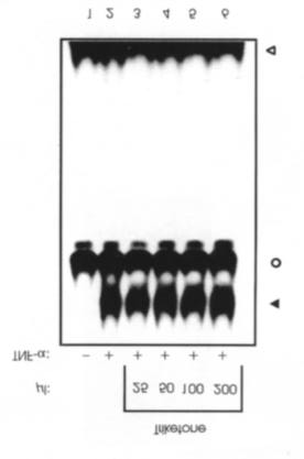 5.2 Untersuchung der anti-inflammatorischen Aktivität der b -Triketone Im Rahmen der Untersuchung, ob β-triketone die Aktivität des Transkriptionsfaktors NF-κB hemmen, wurden Jurkat T Zellen mit