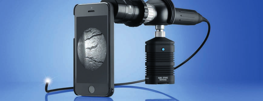 Endoskop-Adapter für Smartphones Möchten Sie einfach, schnell und zu jeder Zeit dokumentieren?