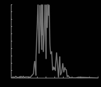 anzeigen. Die EKG-Veränderungen bei DCM sind unspezifisch und können auch durch andere Krankheiten verursacht werden. Oft sieht man bei DCM einen Linksschenkelblock (siehe: <Herzrhythmusstörungen>).