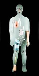 Techn. Assistenzen (im Körper) Z. B. elektronische Sonden, die ins Hirn des Patienten implantiert werden, um den Tremor bei Parkinson zu unterbinden.