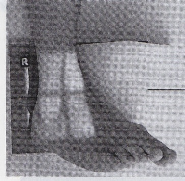 Oberes Sprunggelenk schräg Innenrotation Fehlermöglichkeiten: Fußsohle nicht 90 - Gelenkspalt nicht frei; zu wenig