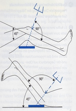 Kniegelenk nach Frik (Tunnelaufnahme) Weitere Variante der Einstellung: Patient in Bauchlage; Zentralstrahl dorsoventral 90 zum Unterschenkel