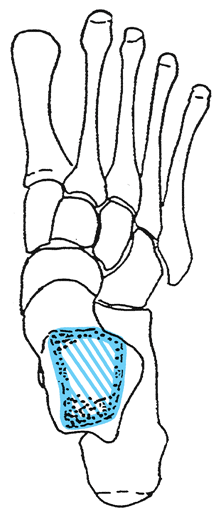 Unteres Sprunggelenk vordere Abteilung Articulatio talocalcaneonavicularis Kugelgelenk: aluskopf zusammengesetzte Pfanne aus Os naviculare (Kahnbein) zwei Gelenkfacetten des alcaneus (Fersenbein),