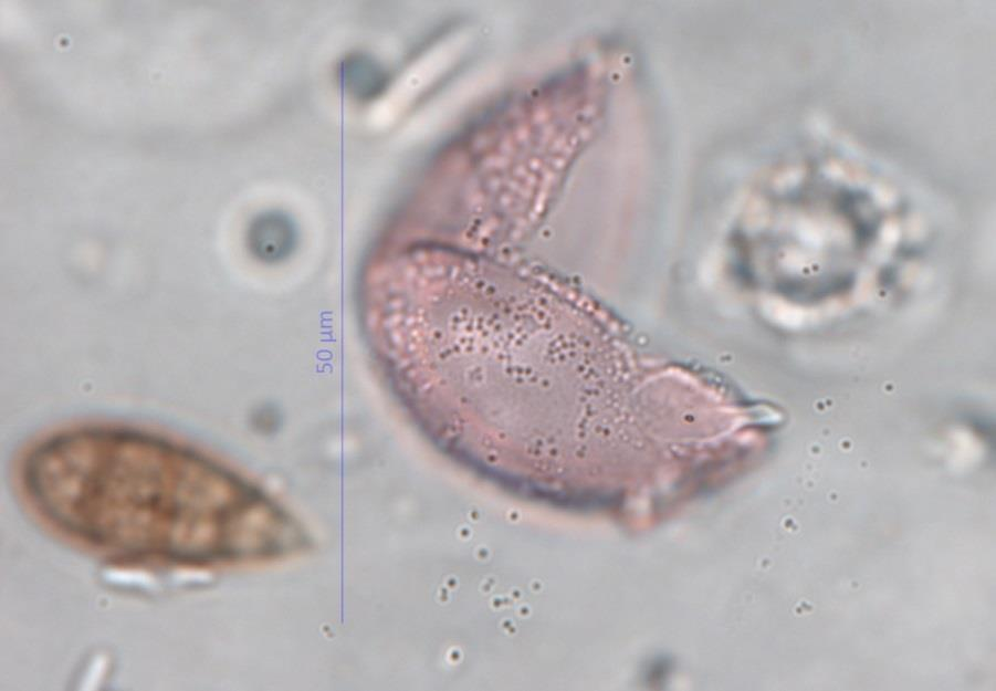 ) Ausgetretenes Cytoplasma mit Intinehülle rechts verschwommen erkennbar. Quelle: Luftstaubpräparat Delmenhorst vom 29.