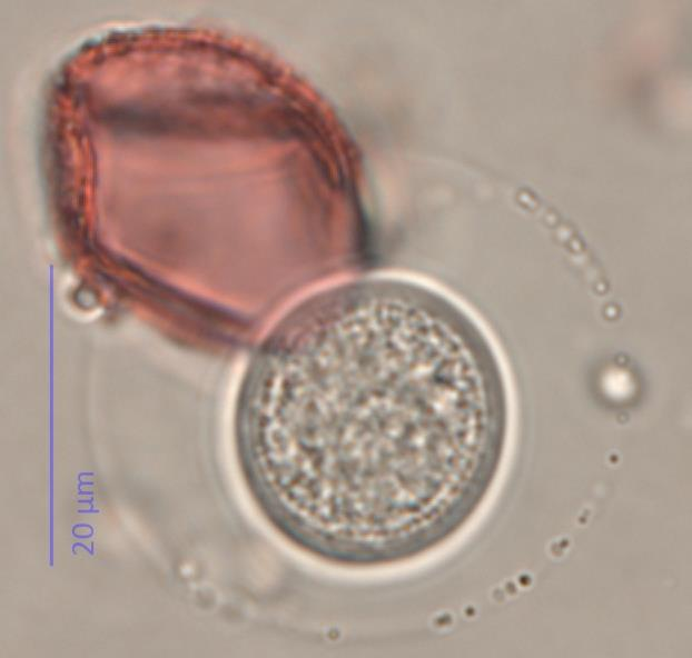 Januar 2014 - Intine auffällig dick (bei Cupressus sempervirens nach polleninfo.