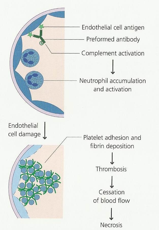 Hyperakute Abstossung Hyperakute Abstossung zeigt immunologisches Gedächtnis. Es liegen spezifische Antikörper gegen das Transplantat vor.