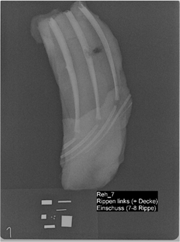 Anhang 4 Röntgenbilder mit Geschoßsplittern Schablone