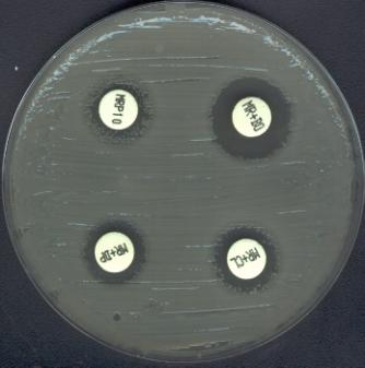 Carbapenemase-Bestätigungstest (Fa. Rosco): Synergismus Meropenem-Borsäure = Nachweis der Klasse A-Carbapenemase KPC (Klebsiella pneumoniae Carbapenemase) 11.6 Clostridium difficile Die C.