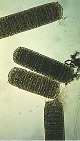 Deferribacter Cytophaga Planctocymes/Pirella Verrucomicrobien Chlamydien Cyanobakterien Actinobakterien Heliobakterien