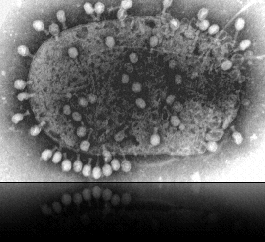 DIE RESTRIKTIONSENDONUKLEASEN - Manche Bakterienstämme sind gegen Infektion mit Bakteriophagen immun, sie produzieren Enzyme, die die Phagen-DNA abbaut, noch bevor sie sich replizieren kann