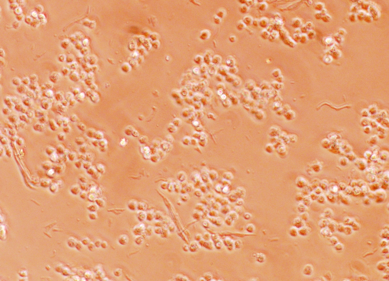 Je geringer der Wert, desto schädigender der Extrakt. Abbildung 4.1: Gesunde RTL-W1 Zellen (links) und geschädigte Zellen der Positivkontrolle mit 3,5-DCP (rechts).