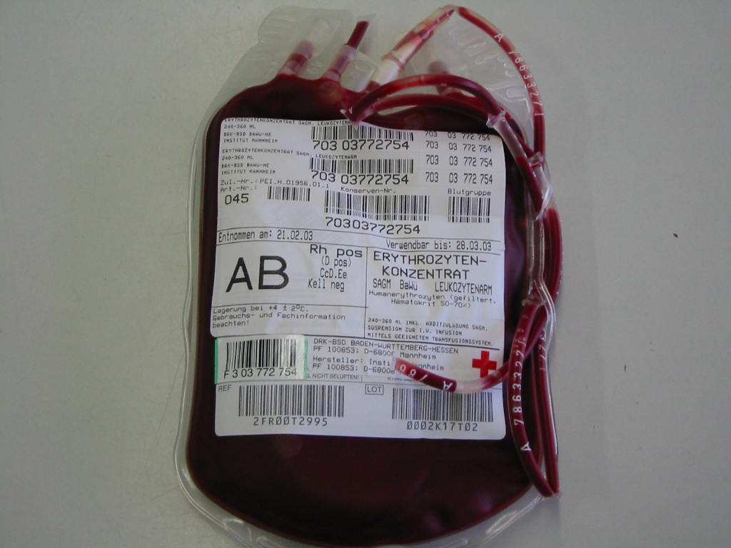 Beispiel: Übertragung von Spendererythrozyten der Blutgruppe AB auf einen