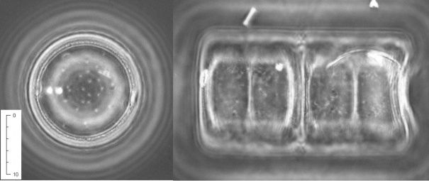 IKSR CIPR ICBR Bewirtschaftungsplan 2015 IFGE Rhein Kapitel 4 1 2 10 µm 10 µm 10 µm 3 4 5 6 Abbildung 15: Fotos von 4 aspektbildenden Arten benthischer Kieselalgen (Diatomeen) in den verschiedenen