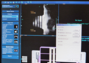 DynaCAD-Software zur Biopsieplanung Biopsiehalterung Vorbereitung zum Ganzköper-MRT Arbeitsplatz am neuen 1,5 T MRT Philips