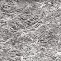 Die offene Mikrostruktur erlaubt ein Überwachsen Sowohl die eptfe-membran als auch der Draht, aus denen der GORE CARDIOFORM Septal Occluder besteht, werden seit langer Zeit für Implantate verwendet