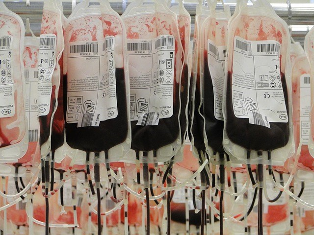 itok Blood Services Solution itok Blood Services Solution, eine umfassende Lösung für Blutspendedienste Ausgangslage Blutspendedienste arbeiten in der Regel mit Blutbank Software wie z.b. eprogesa oder Inlog zur Abdeckung ihrer Hauptprozesse.
