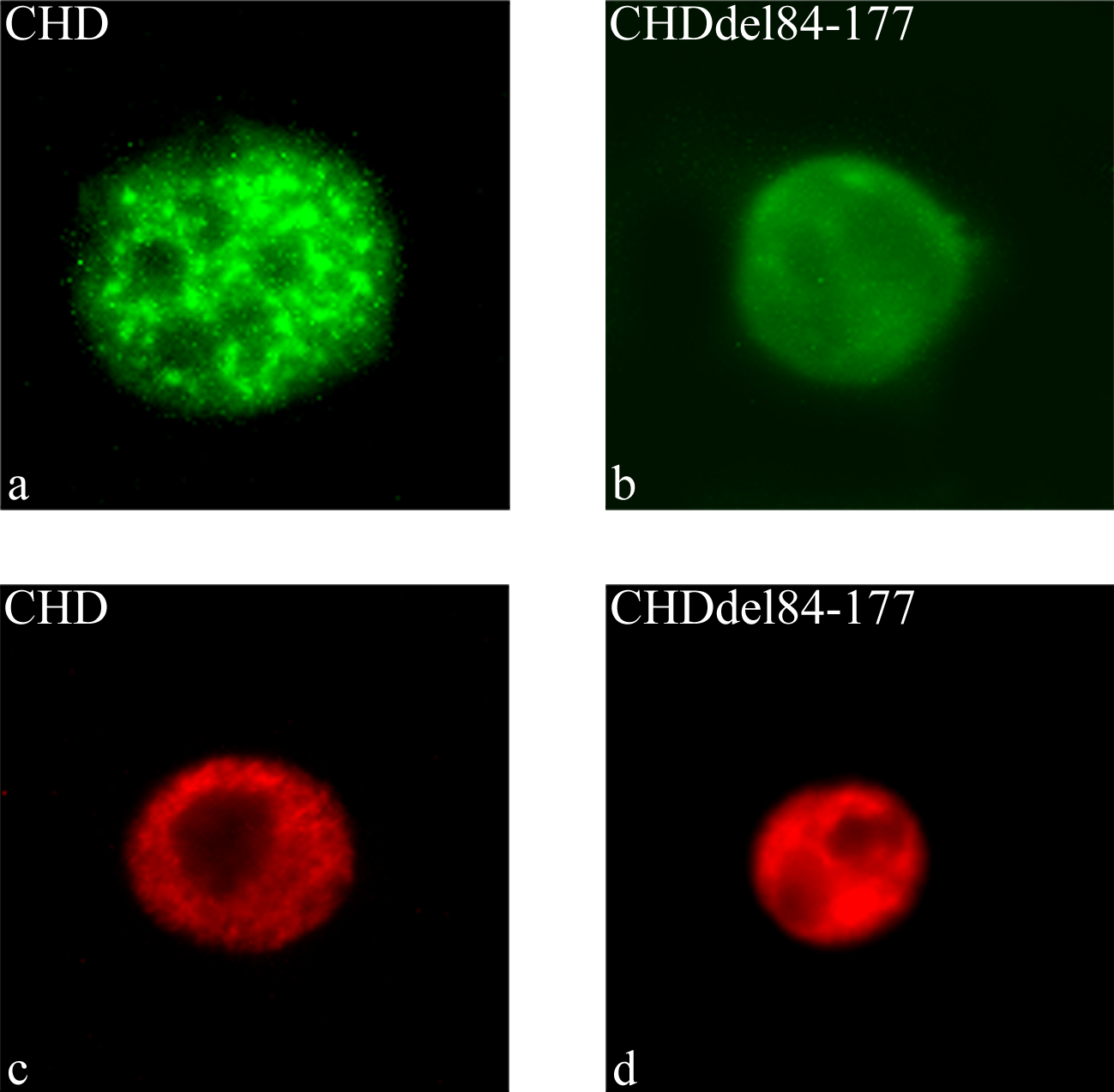 Abb. 8: Die Deletion der Speckling-Domäne verhindert die Lokalisation von Wt1 (+KTS) in Speckles. Immunzytochemische Analyse von U2OS-Zellen (a und b) bzw.