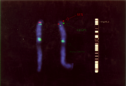 werden) Metaphasechromosom Gen-Kartierung durch In-situ-Hybridisierung Hybrid aus Sonden-DNA und chromosomaler DNA