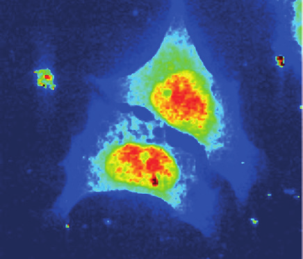 Lebende Zellen im harten Röntgenlicht von PETRA III. Die Farbe gibt Auskunft darüber, wie stark die Röntgenstrahlung an der jeweiligen Stelle gestreut wird.