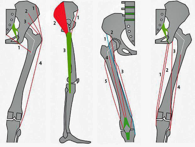 Die zweigelenkigen Muskeln (Abb.8) wirken auf die Articulatio coxae sowie das Kniegelenk (Articulatio genus). Hier wird allein die Wirkung auf die Articulatio coxae betrachtet: Außenrotation M.