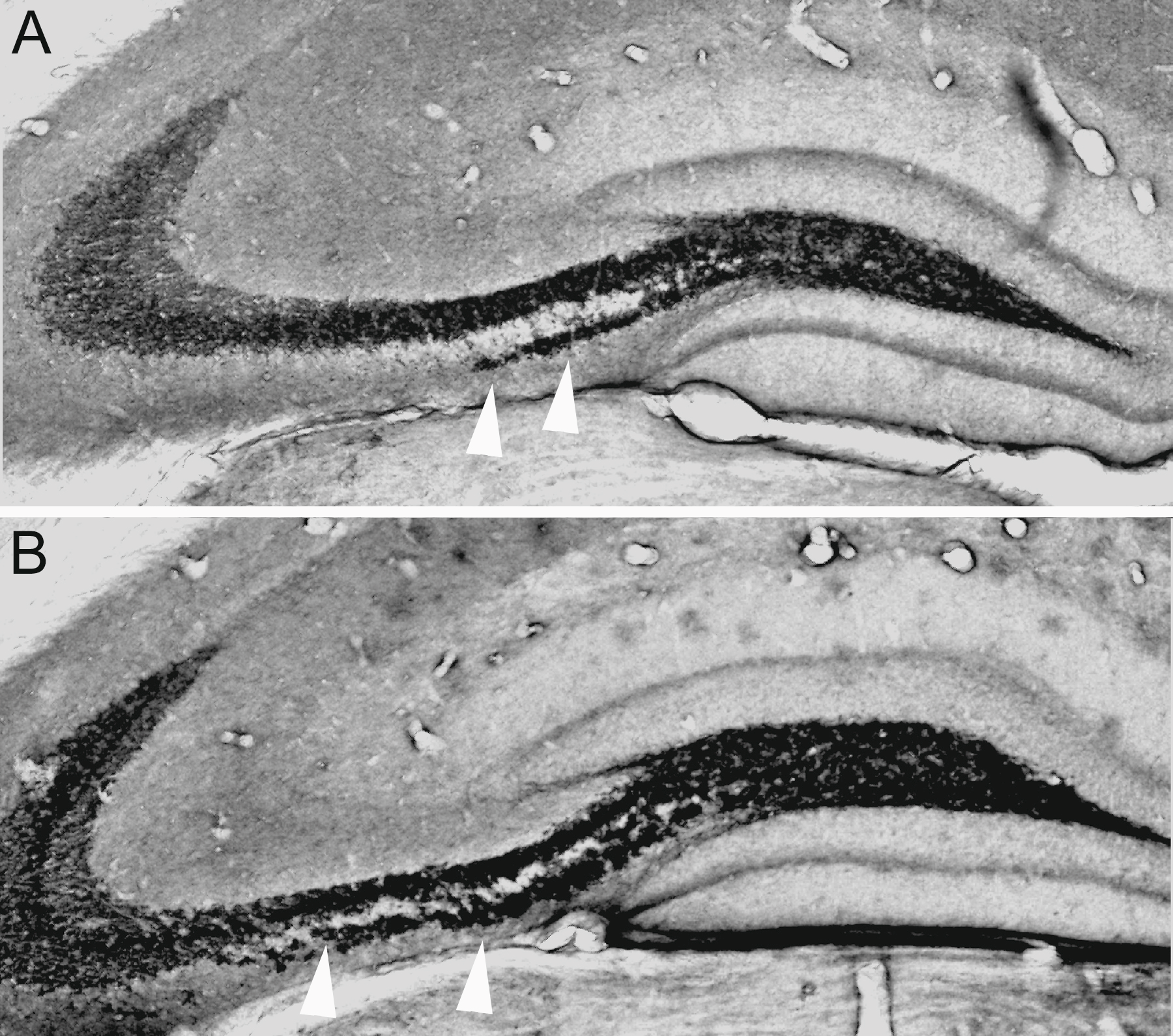Abbildung 6: Neben Unterschieden der Neurogeneserate bestehen zwischen den beiden Mäusestämmen C57BL/6 (B) und DBA (A) auch Unterschiede hinsichtlich der Morphologie der Moosfaserfelder.