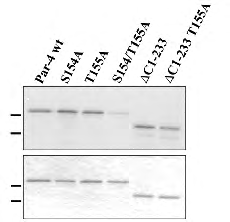 ERGEBNISSE 97 Phosphorylierungsintensität zeigte, konnte eine Phosphorylierung des Par-4 Proteins durch die PKA an der Position T155 und im C-Terminus des Par-4 Proteins ausgeschlossen werden.