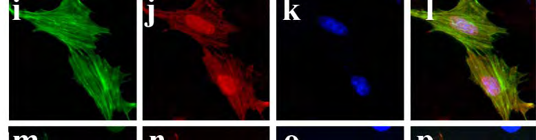 ERGEBNISSE 100 Inhibition der PKA einen Einfluss auf die Par-4/Dlk-vermittelte Apoptose hat. Dazu wurde ein Koexpressionsexperiment mit FLAG-Dlk und Par-4-GFP in REF52.