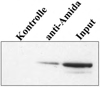 ERGEBNISSE 113 präzipitieren (Abb. 39, Spur 1). Dieses Ergebnis zeigt, dass Amida in vivo auch mit der Dlk einen Komplex eingehen kann. IP : anti Amida WB: anti GFP GFP-Dlk 1 2 3 Abb.