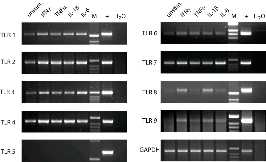 Ergebnisse interessanterweise TNFα, ein Mediator von geringerem Einfluss auf die anderen TLRs, hier einen höheren Anstieg im Expressionsniveau verursachte als z.b. IL-6. Abb. 3.