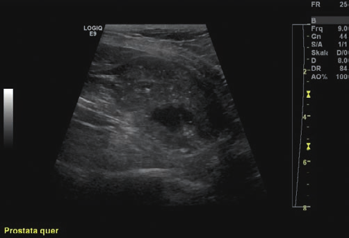 prostata hund ultraschall
